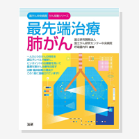 最先端治療　肺がん（国がん中央病院がん攻略シリーズ）